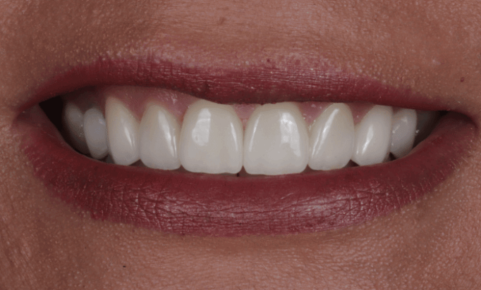 After -Bond Dental London