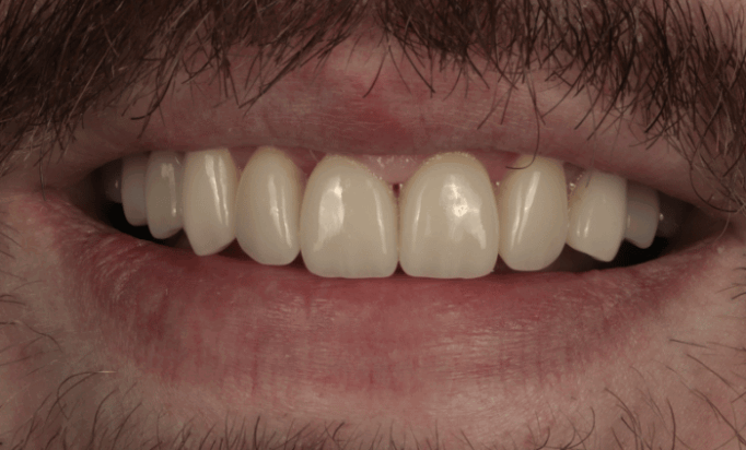 After -Bond Dental London