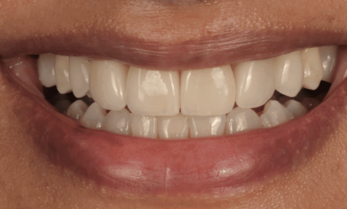 After -Bond Dental London