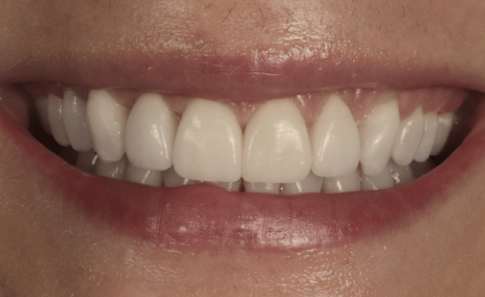After -Bond Dental London