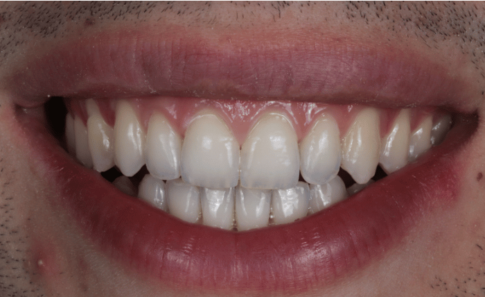 After -Bond Dental London