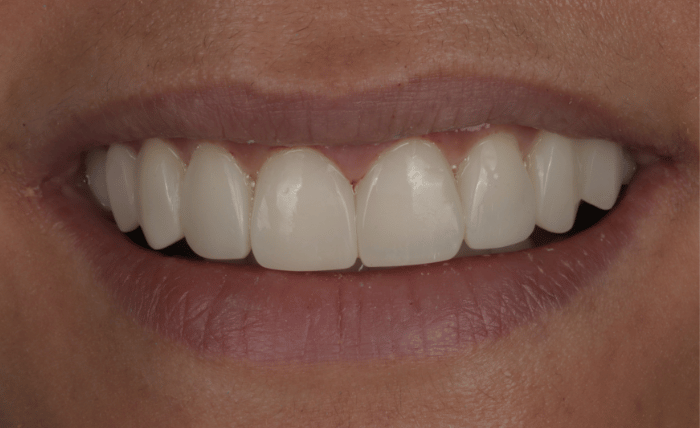 After -Bond Dental London
