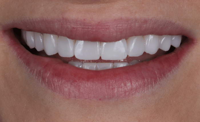 After -Bond Dental London