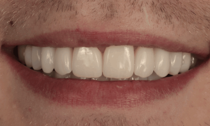 After -Bond Dental London