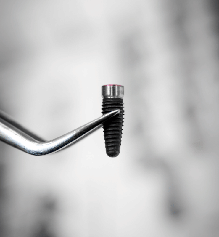 Treatment Category - Bond Dental London