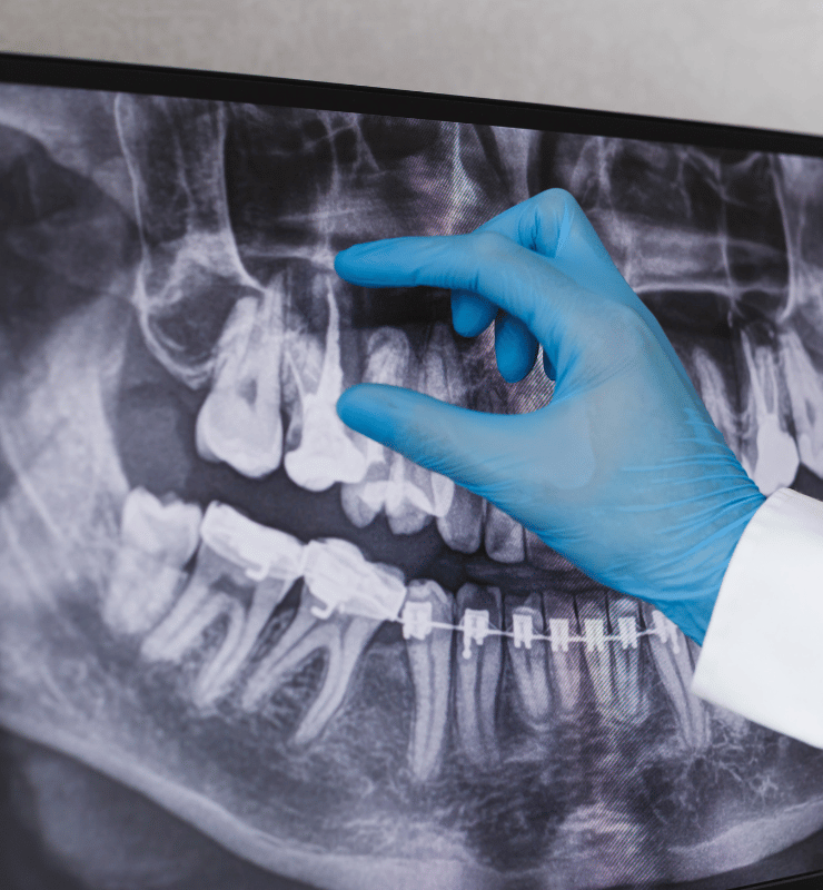 Treatment -  Bond Dental London