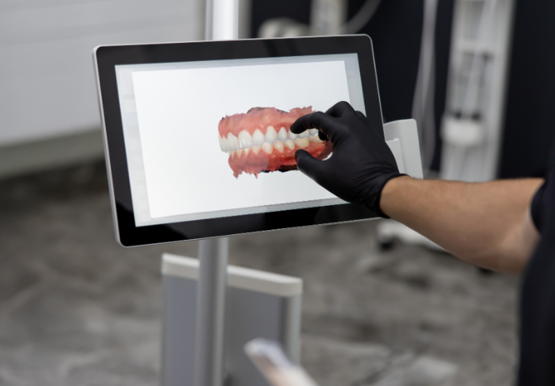 3D Scanning