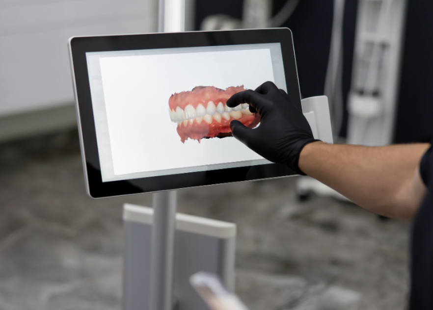 3D Scanning
